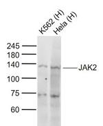 JAK2 Antibody in Western Blot (WB)