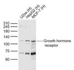 Growth hormone receptor Antibody in Western Blot (WB)