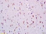 ARHGAP17 Antibody in Immunohistochemistry (Paraffin) (IHC (P))