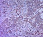 Vimentin Antibody in Immunohistochemistry (Paraffin) (IHC (P))