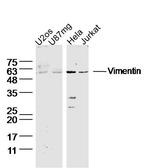 Vimentin Antibody in Western Blot (WB)