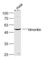 Vimentin Antibody in Western Blot (WB)