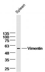Vimentin Antibody in Western Blot (WB)