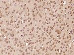 ATF6 Antibody in Immunohistochemistry (Paraffin) (IHC (P))