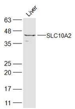 SLC10A2 Antibody in Western Blot (WB)