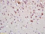 APOA1 Antibody in Immunohistochemistry (Paraffin) (IHC (P))