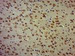 SOX2 Antibody in Immunohistochemistry (Paraffin) (IHC (P))