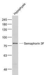 Semaphorin 3F Antibody in Western Blot (WB)