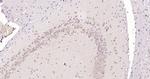 MCL1 Antibody in Immunohistochemistry (Paraffin) (IHC (P))