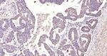 MCL1 Antibody in Immunohistochemistry (Paraffin) (IHC (P))