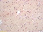 DGAT1/Diglyceride acyltransferase Antibody in Immunohistochemistry (Paraffin) (IHC (P))