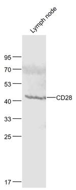 CD28 Antibody in Western Blot (WB)