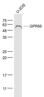 NMUR1 Antibody in Western Blot (WB)