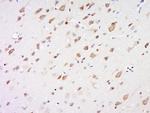 LPL protein/Lipoprotein lipase Antibody in Immunohistochemistry (Paraffin) (IHC (P))