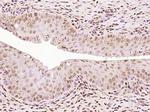 Progesterone Receptor Antibody in Immunohistochemistry (Paraffin) (IHC (P))