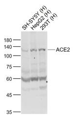 ACE2 Antibody in Western Blot (WB)