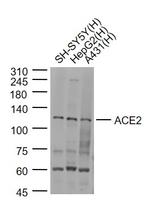 ACE2 Antibody in Western Blot (WB)