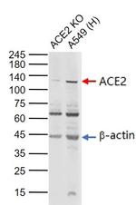 ACE2 Antibody in Western Blot (WB)