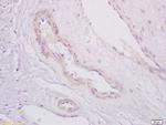 PDE5A Antibody in Immunohistochemistry (Paraffin) (IHC (P))