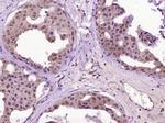 WEE1 Antibody in Immunohistochemistry (Paraffin) (IHC (P))