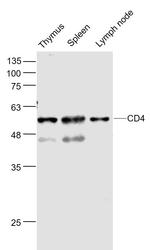 CD4 Antibody in Western Blot (WB)