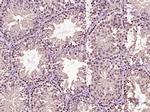 Beta catenin Antibody in Immunohistochemistry (Paraffin) (IHC (P))