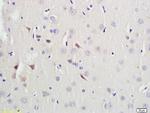 ganglioside GM1 Antibody in Immunohistochemistry (Paraffin) (IHC (P))