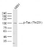 Phospho-Tau (Thr548) Antibody in Western Blot (WB)