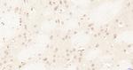 CDKN2A/p16-INK4a Antibody in Immunohistochemistry (Paraffin) (IHC (P))