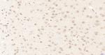 CDKN2A/p16-INK4a Antibody in Immunohistochemistry (Paraffin) (IHC (P))