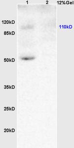KLF5 Antibody in Western Blot (WB)