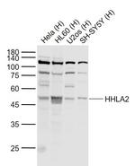 HHLA2 Antibody in Western Blot (WB)