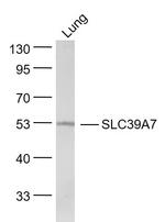 SLC39A7 Antibody in Western Blot (WB)