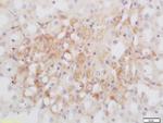 GNMT Antibody in Immunohistochemistry (Paraffin) (IHC (P))