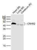 CRHR2 Antibody in Western Blot (WB)