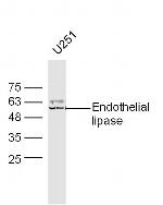Endothelial lipase Antibody in Western Blot (WB)