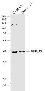 PNPLA3 Antibody in Western Blot (WB)