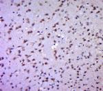 Aldolase A, Aldolase B Antibody in Immunohistochemistry (Paraffin) (IHC (P))
