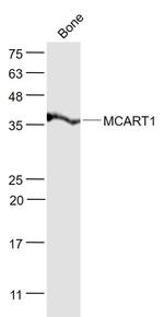 MCART1 Antibody in Western Blot (WB)