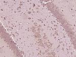 MCFD2 Antibody in Immunohistochemistry (Paraffin) (IHC (P))