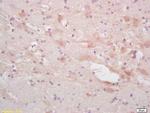 alpha Internexin Antibody in Immunohistochemistry (Paraffin) (IHC (P))