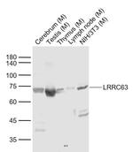 LRRC63 Antibody in Western Blot (WB)