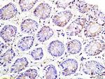 NKG2A Antibody in Immunohistochemistry (Paraffin) (IHC (P))