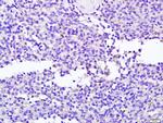 NCR2 Antibody in Immunohistochemistry (Paraffin) (IHC (P))