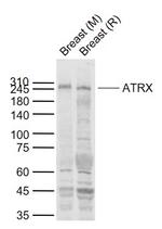 ATRX Antibody in Western Blot (WB)