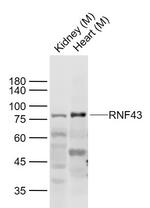 RNF43 Antibody in Western Blot (WB)