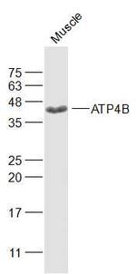 ATP4B Antibody in Western Blot (WB)