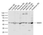 MSR1 Antibody in Western Blot (WB)