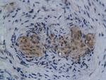 ENPP2 Antibody in Immunohistochemistry (Paraffin) (IHC (P))