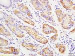 ENPP2 Antibody in Immunohistochemistry (Paraffin) (IHC (P))
